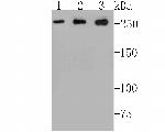 ADAMTS13 Antibody in Western Blot (WB)