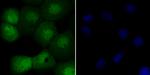 UNC84A Recombinant Rabbit Monoclonal Antibody (JG95-31)
