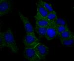 Nectin 2 Recombinant Rabbit Monoclonal Antibody (JG39-64)