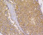 Nectin 2 Antibody in Immunohistochemistry (Paraffin) (IHC (P))