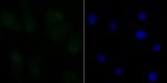 CtBP1 Antibody in Immunocytochemistry (ICC/IF)