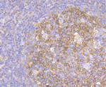 METAP2 Antibody in Immunohistochemistry (Paraffin) (IHC (P))