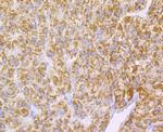 Monoamine Oxidase B Antibody in Immunohistochemistry (Paraffin) (IHC (P))