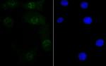 RXRA Antibody in Immunocytochemistry (ICC/IF)