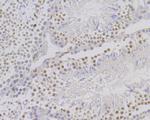 Mgea5 Antibody in Immunohistochemistry (Paraffin) (IHC (P))