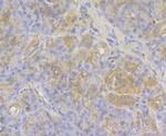 Mgea5 Recombinant Rabbit Monoclonal Antibody (JG40-05)