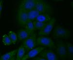 CYP27A1 Recombinant Rabbit Monoclonal Antibody (JG40-36)
