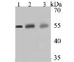 CYP27A1 Antibody in Western Blot (WB)