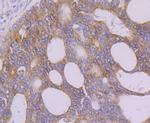 FAAH Recombinant Rabbit Monoclonal Antibody (JG43-07)
