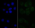 TAP Recombinant Rabbit Monoclonal Antibody (JE40-63)
