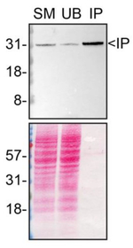 Syntenin 1 Antibody in Immunoprecipitation (IP)