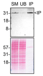 Syntenin 1 Antibody in Immunoprecipitation (IP)