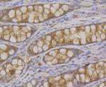 Syntenin 1 Antibody in Immunohistochemistry (Paraffin) (IHC (P))