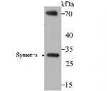 Syntenin 1 Antibody in Western Blot (WB)