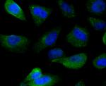 IMPDH2 Recombinant Rabbit Monoclonal Antibody (JE40-87)