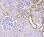 IMPDH2 Antibody in Immunohistochemistry (Paraffin) (IHC (P))