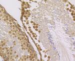 IMPDH2 Antibody in Immunohistochemistry (Paraffin) (IHC (P))