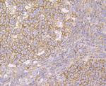 IMPDH2 Antibody in Immunohistochemistry (Paraffin) (IHC (P))