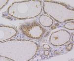 IMPDH2 Antibody in Immunohistochemistry (Paraffin) (IHC (P))