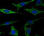 FIS1 Recombinant Rabbit Monoclonal Antibody (JE40-90)