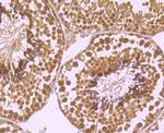 XPO5 Antibody in Immunohistochemistry (Paraffin) (IHC (P))