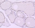 XPO5 Recombinant Rabbit Monoclonal Antibody (JE40-91)