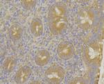 MARK2 Antibody in Immunohistochemistry (Paraffin) (IHC (P))