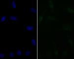 BAF57 Recombinant Rabbit Monoclonal Antibody (JE41-11)