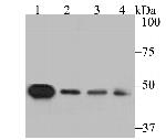 SFRP4 Recombinant Rabbit Monoclonal Antibody (JE41-41)