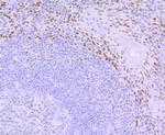 DDB2 Antibody in Immunohistochemistry (Paraffin) (IHC (P))
