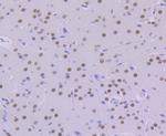 KHSRP Antibody in Immunohistochemistry (Paraffin) (IHC (P))