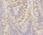 CLASP1 Antibody in Immunohistochemistry (Paraffin) (IHC (P))
