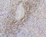 ADAP Antibody in Immunohistochemistry (Paraffin) (IHC (P))