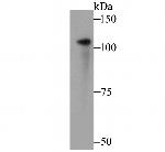 ADAP Antibody in Western Blot (WB)