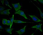 MARK3 Recombinant Rabbit Monoclonal Antibody (JE44-84)