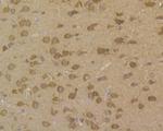 PP1 beta Antibody in Immunohistochemistry (Paraffin) (IHC (P))