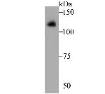 ATP2A1 Antibody in Western Blot (WB)