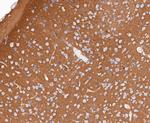 GNB2 Antibody in Immunohistochemistry (Paraffin) (IHC (P))