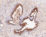 NDUFAF1 Antibody in Immunohistochemistry (Paraffin) (IHC (P))