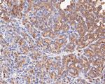 NDUFAF1 Antibody in Immunohistochemistry (Paraffin) (IHC (P))