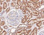 NDUFAF1 Antibody in Immunohistochemistry (Paraffin) (IHC (P))