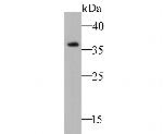 NDUFAF1 Antibody in Western Blot (WB)
