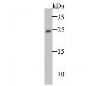 TC10 Recombinant Rabbit Monoclonal Antibody (JE47-25)
