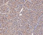 COPS3 Antibody in Immunohistochemistry (Paraffin) (IHC (P))