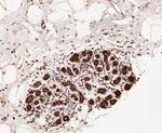 COPS3 Antibody in Immunohistochemistry (Paraffin) (IHC (P))