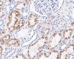 ENTPD5 Recombinant Rabbit Monoclonal Antibody (JE47-87)