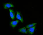 ACADM Recombinant Rabbit Monoclonal Antibody (JE48-09)