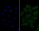 HSF2 Recombinant Rabbit Monoclonal Antibody (JE48-40)