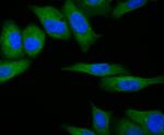 RSK1 Recombinant Rabbit Monoclonal Antibody (JE48-76)