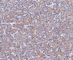 ENTPD5 Recombinant Rabbit Monoclonal Antibody (JE48-94)